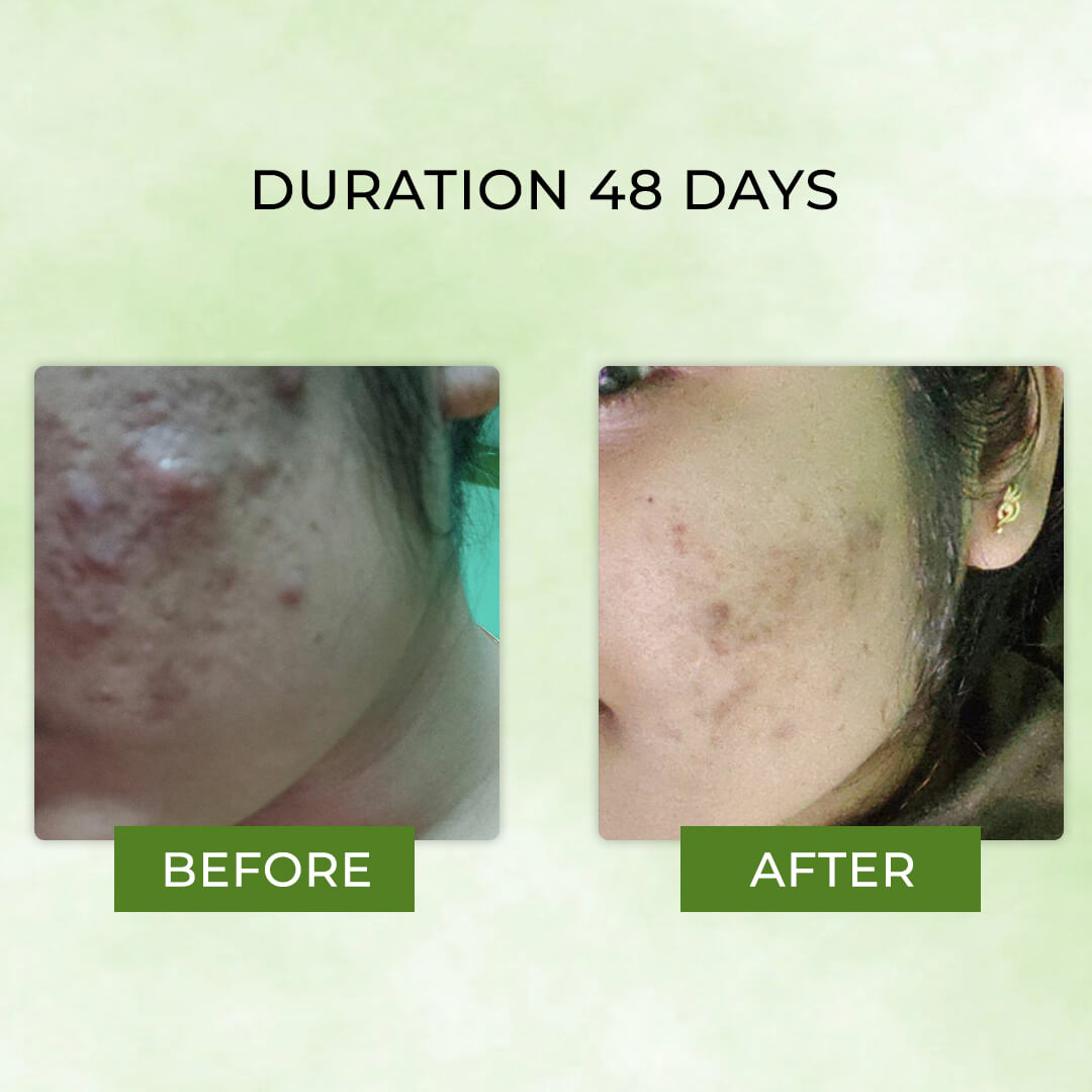 Grewaa Green tea gel
