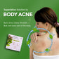 Pimple Fighter Soap | Medicinal Treatment Bar