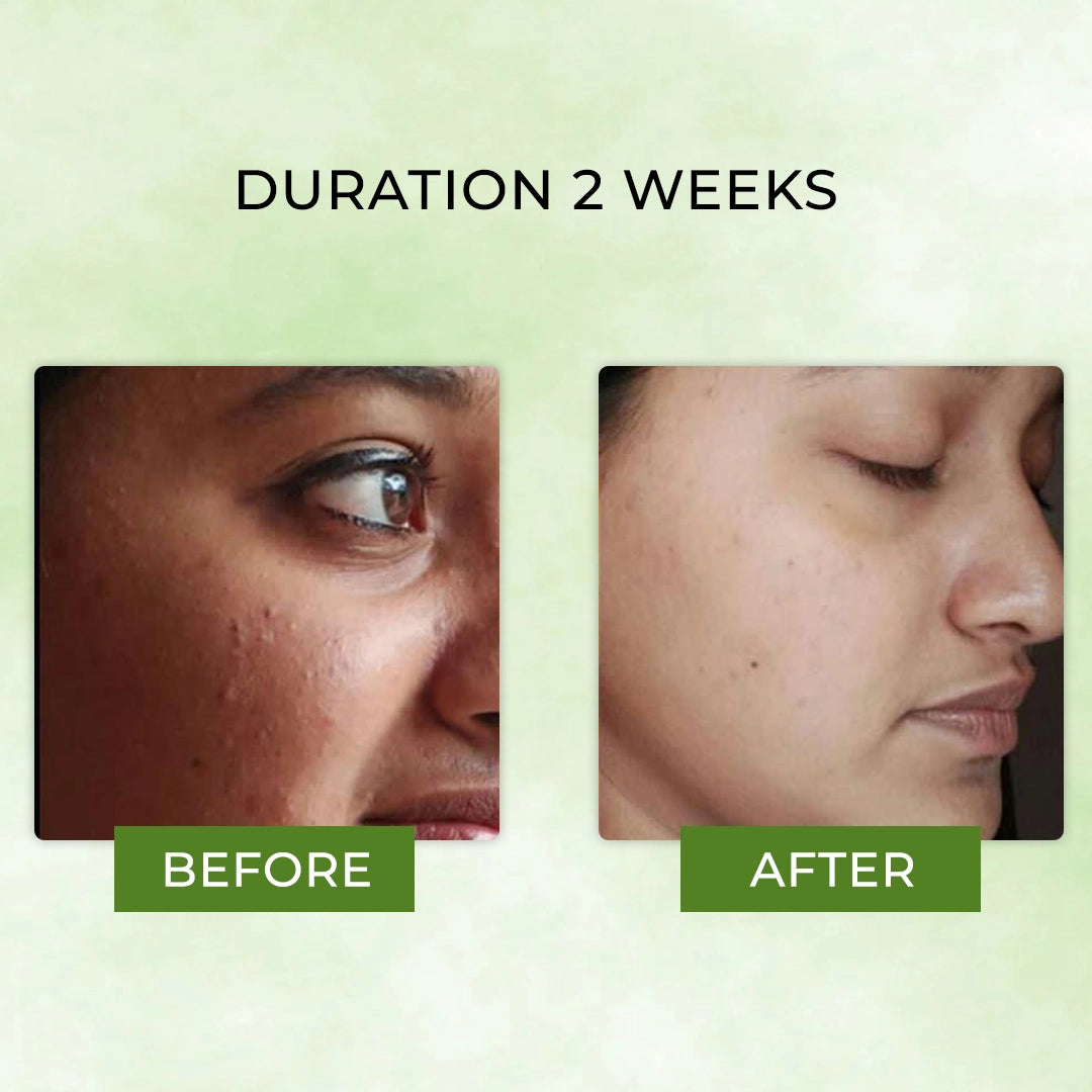 Grewaa Green tea gel